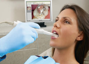 Dentist Intra-Oral Camera and Patient