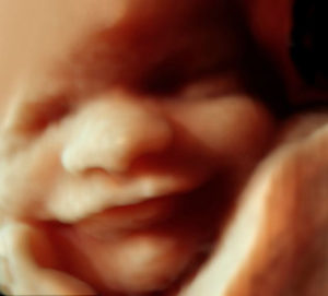 Ultrasound of Smiling Baby In The Womb